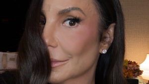 Ivete Sangalo revela como está seu rosto após queda em casa; confira