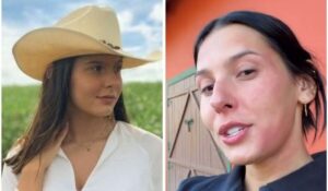 Ana Castela desabafa após acidente e compara com fotos antigas