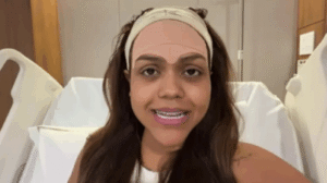 Aos 31 anos, Camila Loures faz cirurgia para remover veia visível na testa que a incomodava