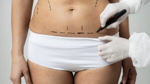 Cuidado com o filtro! Cirurgiã plástica revela 5 mitos PERIGOSOS sobre procedimentos estéticos que viralizaram