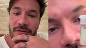 Eliezer impressiona ao mostrar o que retirou da orelha: ‘Olha só o que tinha’