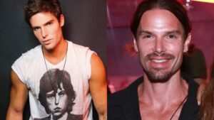 7 Famosos que Explodiram nas Redes por Procedimentos Estéticos