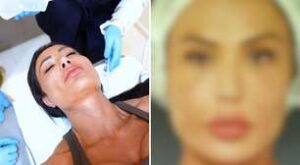 Gracyanne Barbosa faz procedimento invasivo no rosto e desabafa: ‘Não quero mais’