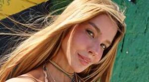 Kerline choca com novo rosto e revela todas as plásticas que fez; confira antes e depois impressionante!