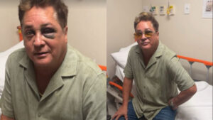 Cantor Leonardo sofre acidente na pescaria e aparece com olho roxo!