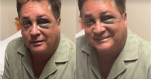 Leonardo sofre susto na pescaria e aparece com olho roxo: veja o que rolou!