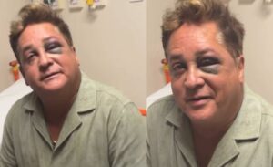 Leonardo sofre queda, fica com olho roxo e vai parar no hospital