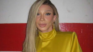 Maya Massafera e o procedimento que ‘destrói a pele’