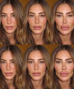 Romana Novais Alerta Fãs Sobre Excesso em Procedimentos Estéticos