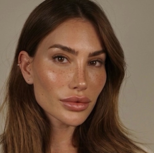 Romana Novais exibe rosto harmonizado e choca web ao revelar detalhes dos procedimentos!