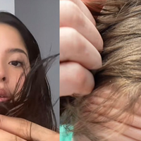 Tendência de não lavar cabelo no TikTok viraliza, mas médica alerta: prepare-se para coceira e sebo em excesso!