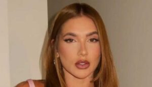 Virginia Fonseca revela diagnóstico de alopecia e desabafa: “Passei muito mal!”