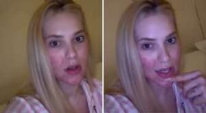 Virginia Fonseca revela novo diagnóstico de alopecia e tranquiliza fãs: tratamento já começou!