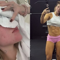 Virginia Fonseca e a batalha contra a enxaqueca