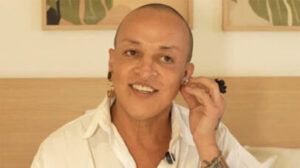 Aos 55 anos, Walério Araújo faz mudança radical no rosto e fica irreconhecível com novos procedimentos