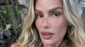 Yasmin Brunet Celebra Perda de 25 kg e Mostra Evolução do Lipedema