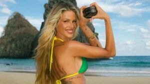 Yasmin Brunet Transforma o Corpo ao Perder 25kg e Melhora Lipedema