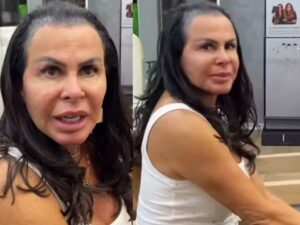 Gretchen abre jogo sobre alopecia e revela a REAL causa da queda de cabelo!