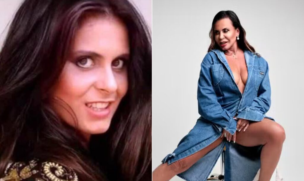 Gretchen volta ao Brasil e abre o jogo sobre suas transformações estéticas