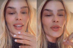 Yasmin Brunet revela doença crônica após abordagem chocante nas ruas do Rio!