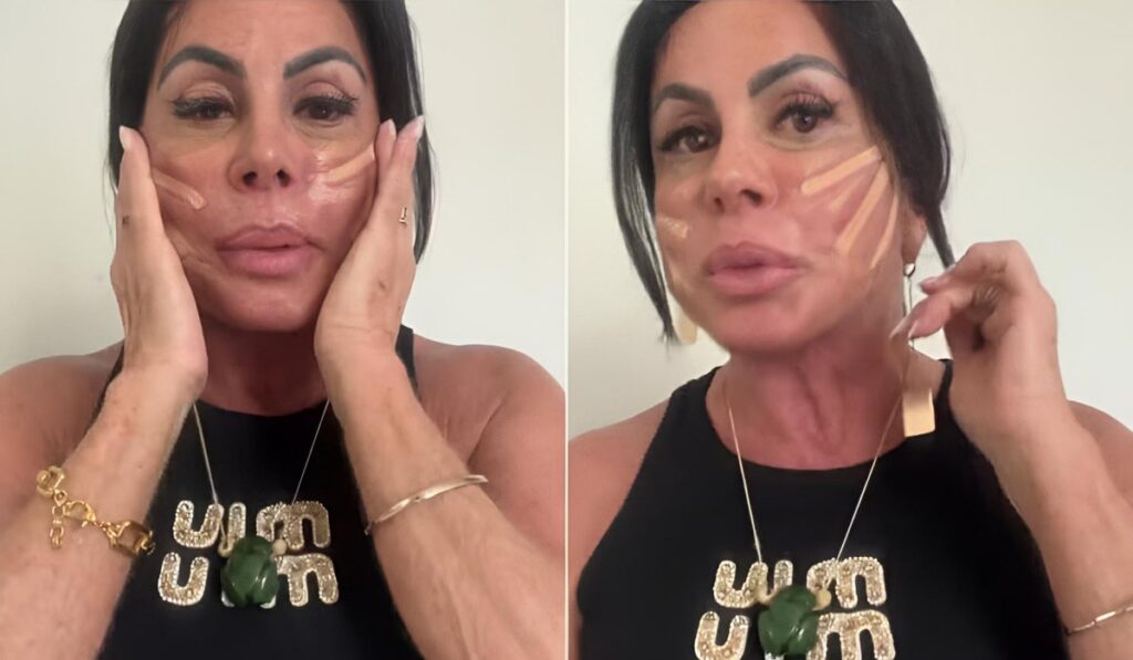 Gretchen exibe resultados de novos procedimentos: ‘Meu rosto tá muito legal’