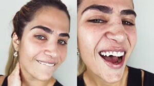 Filha de Leonardo quebra dente após noite romântica e faz revelação bombástica!