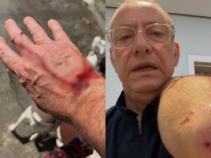 José Roberto Burnier Retorna ao SP2 Após Ataque de Pitbull: Jornalista Desabafa na Web
