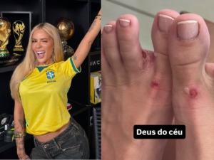 Karoline Lima mostra ferimentos nos pés pelo trabalho na Copa e desabafa