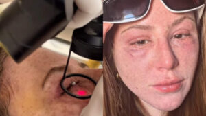 Mari Maria revela sustos com tumores benignos e confessa: ‘Achei que ia morrer’