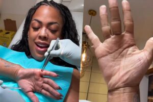 Marvvila passa por cirurgia para remover dedo da mão