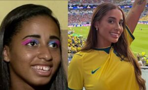 MC Loma Antes e Depois Viraliza e Deixa Galera em Choque