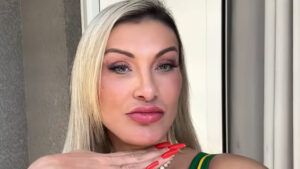 Andressa Urach estreia novo rosto e revela fortuna gasta em procedimento