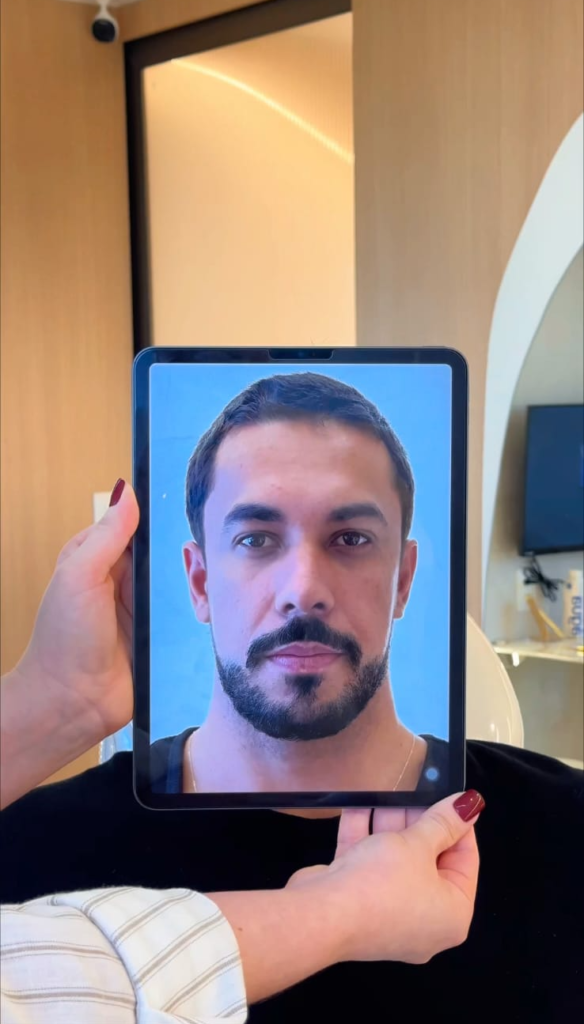 Maike Allan faz harmonização facial e faz alerta importante sobre naturalidade
