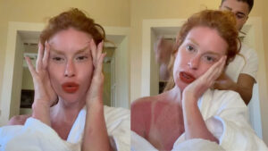 Marina Ruy Barbosa exibe queimadura de sol em férias na Toscana!