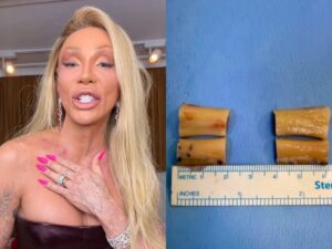 Maya Massafera Mostra Resultado Impressionante de Cirurgia Inédita e Exibe Ossos Removidos!