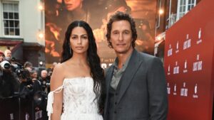 Camila Alves revela segredo de beleza que transformou sua pele radicalmente