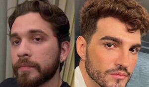 Gustavo Mioto Nega Fake News Envolvendo JÃO