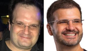 Ilan Kriger Impressiona com Transformação Radical que Choca a Internet