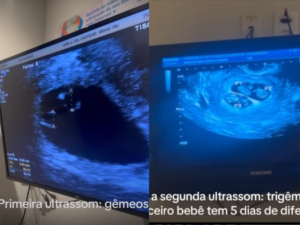 Mulher engravida de 3º bebê enquanto carrega gêmeos: história impressionante do Rio