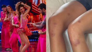 Bianca Andrade mostra corpo todo roxo após dedicação à Dança dos Famosos