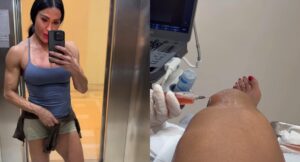 Gracyanne Barbosa passa por procedimento cirúrgico no joelho por causa do Dança dos Famosos