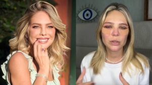 Nora de Leonardo, Thais Gebelein faz cirurgia estética e documenta recuperação