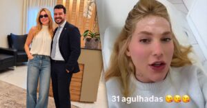 Virginia Fonseca revela 31 aplicações de botox para tratar enxaqueca crônica