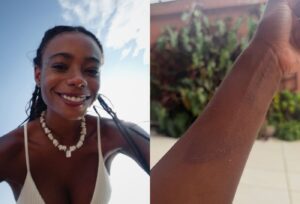 Dandara Couto mostra marcas pelo corpo após três dias desaparecida