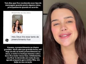 Franciny Ehlke grávida rebate críticas sobre preenchimentos: ‘Chama gravidez’