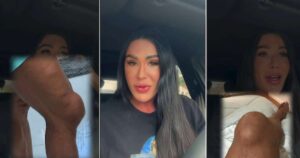 Gracyanne Barbosa revela joelho inchado e desabafa sobre sofrimento nos treinos da ‘Dança dos Famosos’