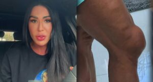 Gracyanne Barbosa celebra recuperação e volta ao Dança dos Famosos sem dor