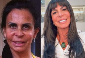 Gretchen revela ter feito mais de 100 procedimentos estéticos: ‘Com certeza’