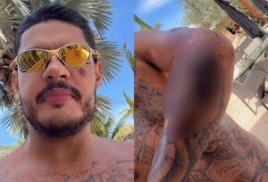 Hungria Hip Hop sofre acidente de moto e choca seguidores com machucados