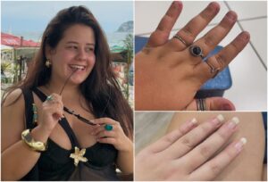 Karol Lannes de ‘Avenida Brasil’ exibe transformação das mãos após abandonar hábito